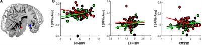 Contrasting Associations Between Heart Rate Variability and Brainstem-Limbic Connectivity in Posttraumatic Stress Disorder and Its Dissociative Subtype: A Pilot Study